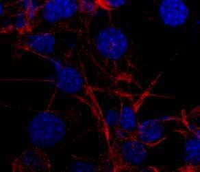 Semi-synthetic hydrogel matrices for studying differences in cell behaviour in 2D and 3D micro-environment