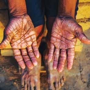 Brick-making to get more efficient and ergonomic