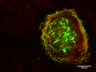 Hydrogel matrices for stem cell transplantation in brain