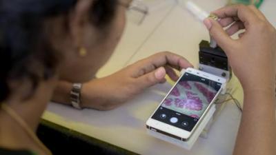 Low-cost lenses to turn smartphones into microscopes