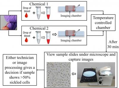 A mobile microscopy and microfluidic platform for sickle cell disease screening