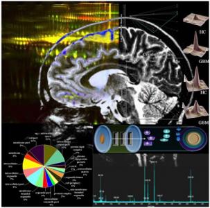 Blood Proteins to detect Brain Tumours