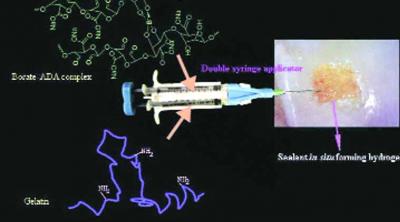 Injectable smart materials for therapy in osteoarthritis