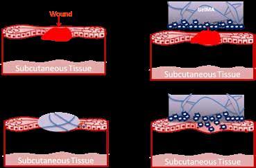 Tissue adhesives