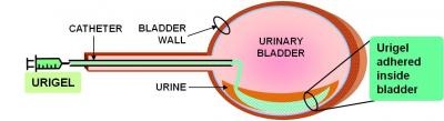 Urigel platforms for bladder diseases