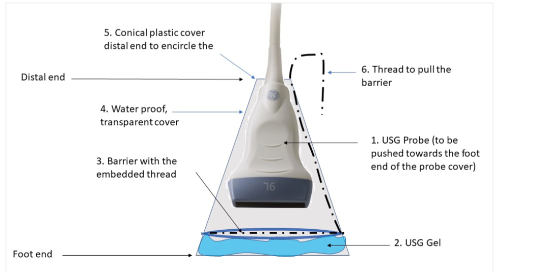  An Ultrasound Probe Cover with a Prefilled and Peelable Pouch Containing Coupling Agent